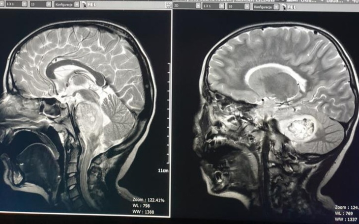 Zbiórka Ratujcie - zdjęcie główne