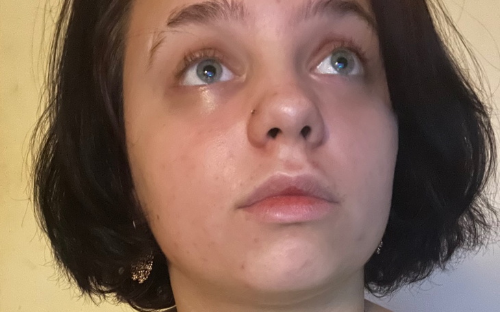 Zbiórka Depresja z napadami - zdjęcie główne