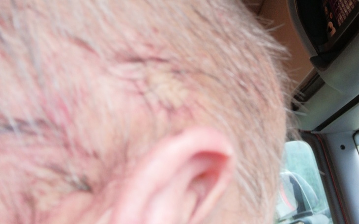 Zbiórka przetrwanie po L4 - zdjęcie główne