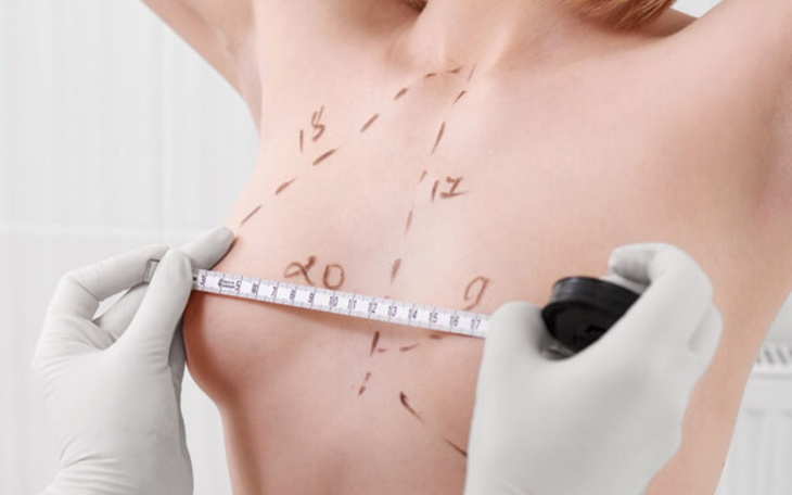 Zbiórka operacja moich marzeń - zdjęcie główne