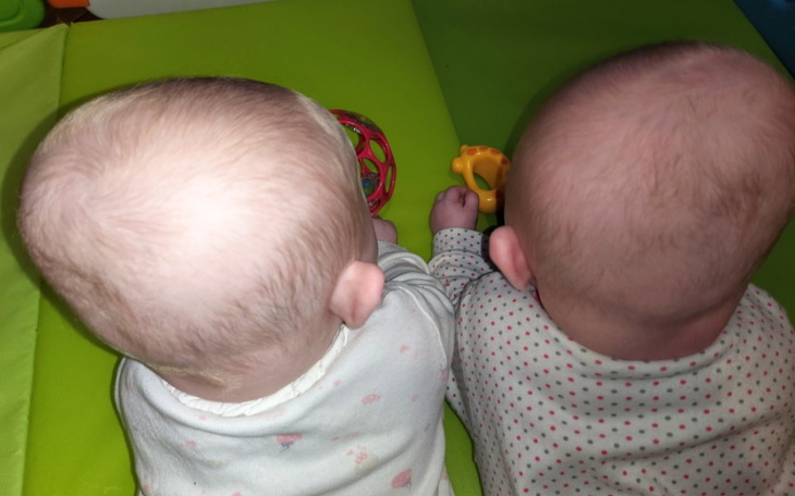 Zbiórka Kaski korekcyjne dla bliźniaczek - zdjęcie główne