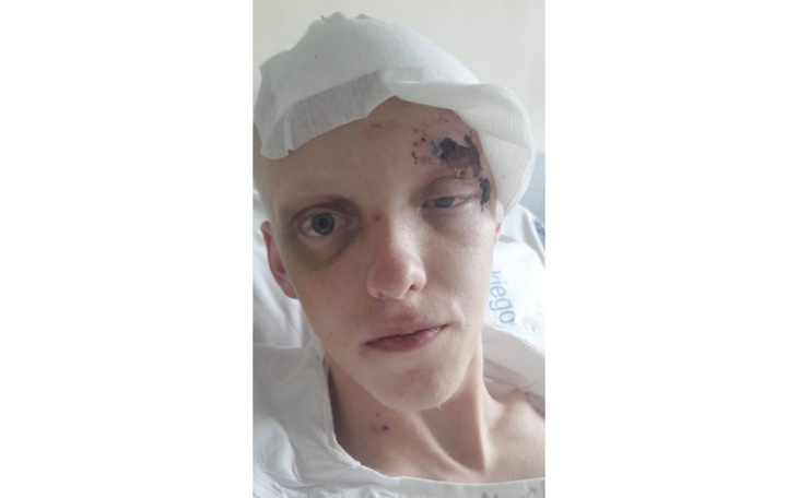 Zbiórka Powrót do normalności Alana - zdjęcie główne