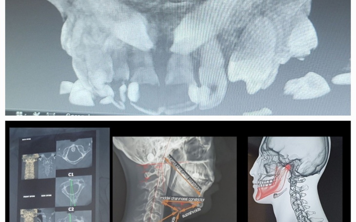 Zbiórka UWAGA Na ratunek szczęki - zdjęcie główne