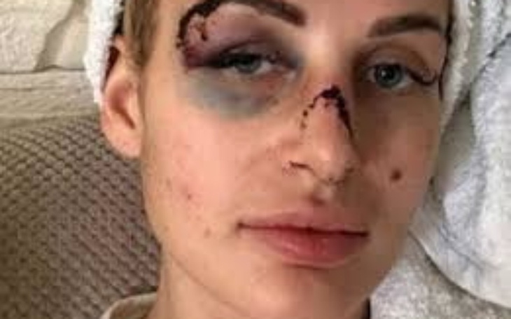 Zbiórka Pomoc ofiarą przemocy - zdjęcie główne