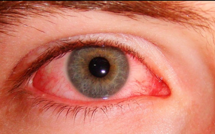 Zbiórka Zbiórka na leczenie oczu - zdjęcie główne