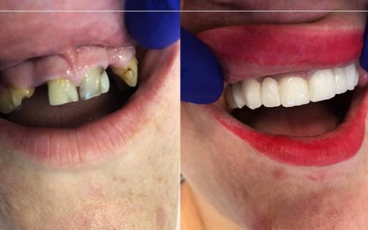 Zbiórka Ostatnia szansa na nowy uśmiech - zdjęcie główne