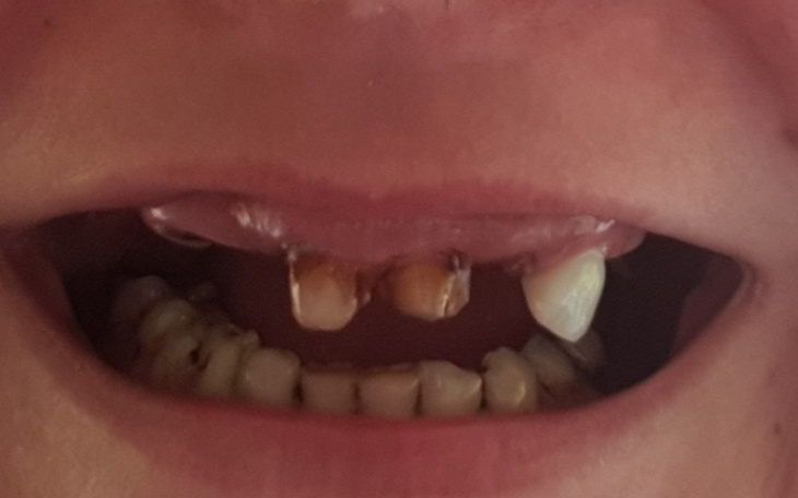 Zbiórka Nowy uśmiech, proteza - zdjęcie główne