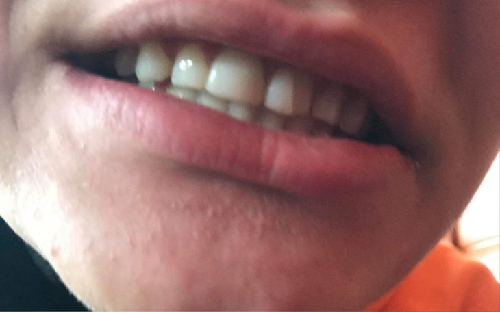 Zbiórka Na naprawę zeba dla ziomka - zdjęcie główne