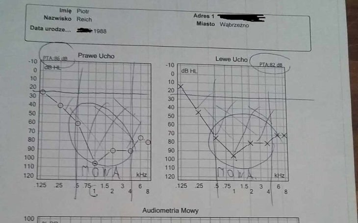 Zbiórka Nowy aparat słuchowy - zdjęcie główne