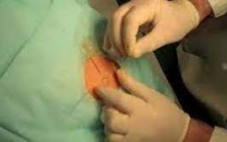 Zbiórka Wszywka dla szarkiego - zdjęcie główne