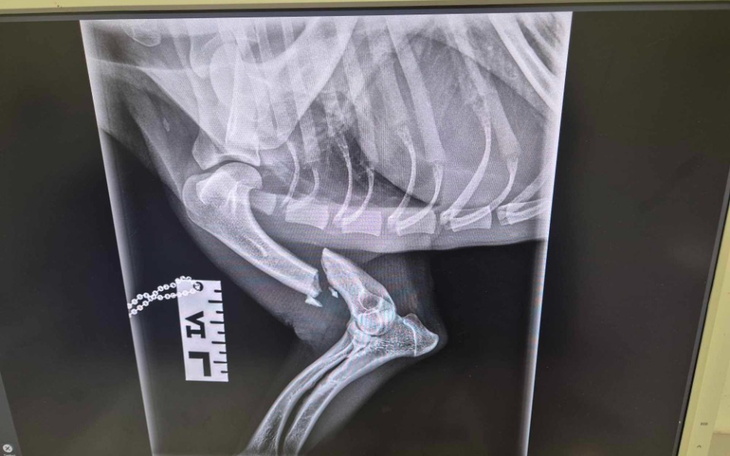 Zdjęcie rentgenowskie kończyny z widocznymi uszkodzeniami.