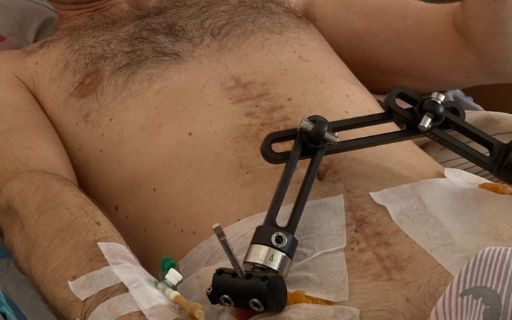 Zbiórka rehabilitacja żołnierza w ciężki - zdjęcie główne