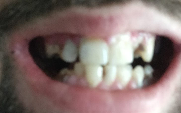 Zbiórka Poprawa uśmiechu - zdjęcie główne