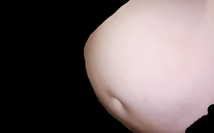 Zbiórka Pilna pomoc na wynajem. - zdjęcie główne