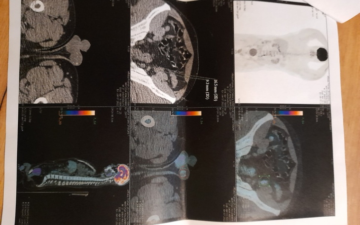 Zbiórka Uratuj zycie - zdjęcie główne