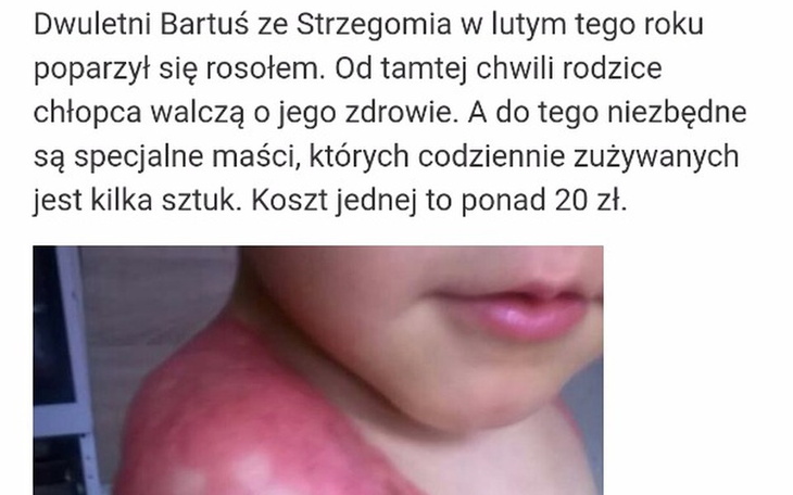 Zbiórka Poparzenia-zbiorka dla Bartusia - zdjęcie główne