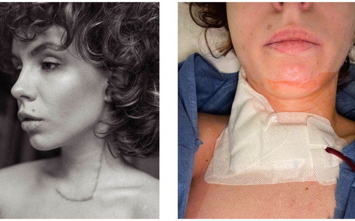 Zbiórka Pomoc w walce z rakiem tarczycy - zdjęcie główne