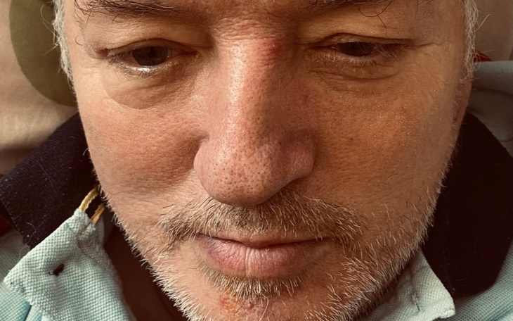 Zbiórka leki dla rodziców i zobowiązania - zdjęcie główne