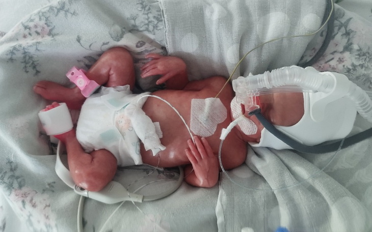 Zbiórka 680g Miłości-wsparcie dla Laury - zdjęcie główne