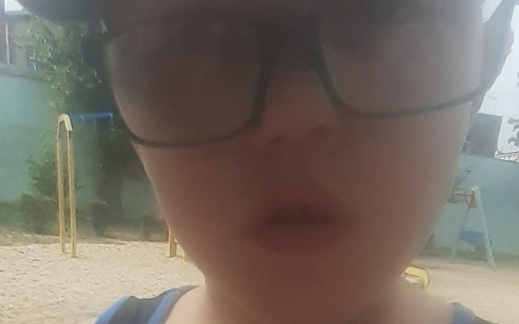 Zbiórka Na specjacjalistyczne alergiczne - zdjęcie główne