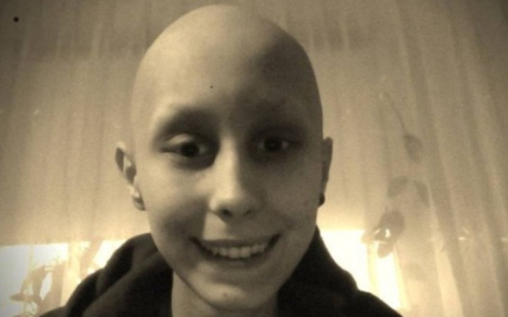 Chłopak z łysą głową, uśmiechający się do kamery.