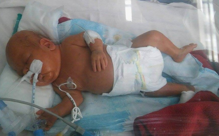 Zbiórka Leczenie i Rehabilitacja Maćka - zdjęcie główne