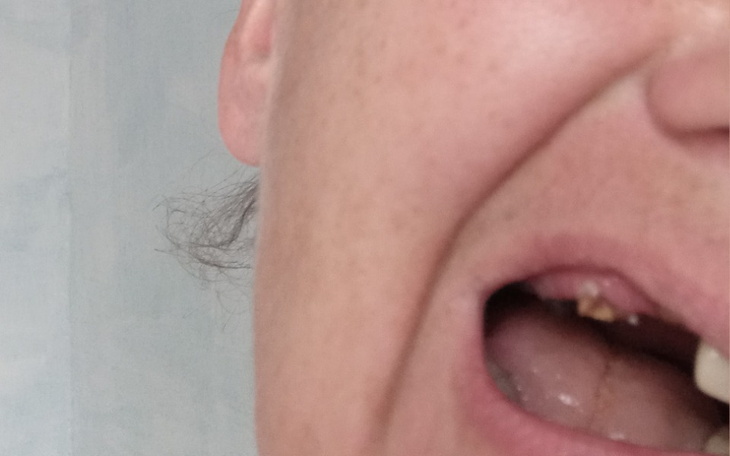 Zbiórka Na zeby po onkologi - zdjęcie główne