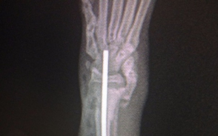 Zbiórka Złamana łapka Zuzi- burej kotki - zdjęcie główne