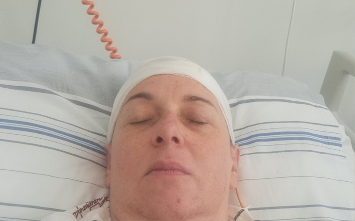 Kobieta leży w szpitalu, z opaską na głowie.