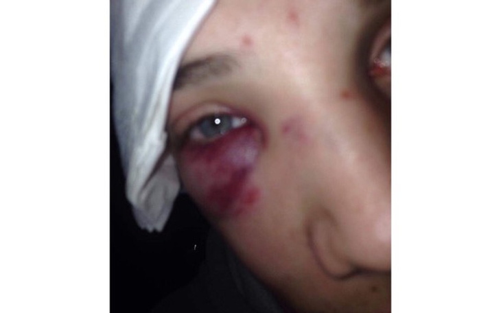 Zbiórka Walka ze strachem i bólem. - zdjęcie główne