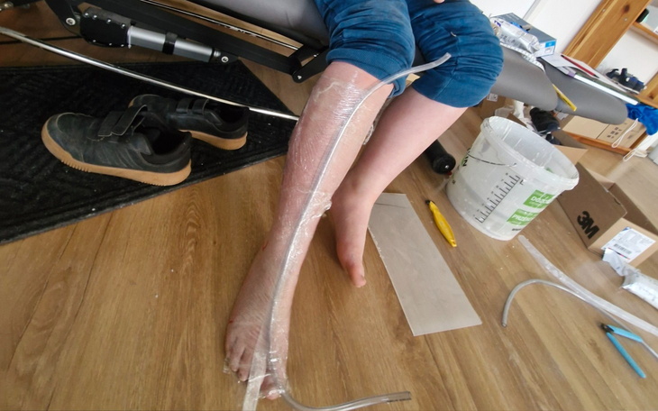 Osoba z nogą owiniętą folią, przygotowująca się do zabiegu.