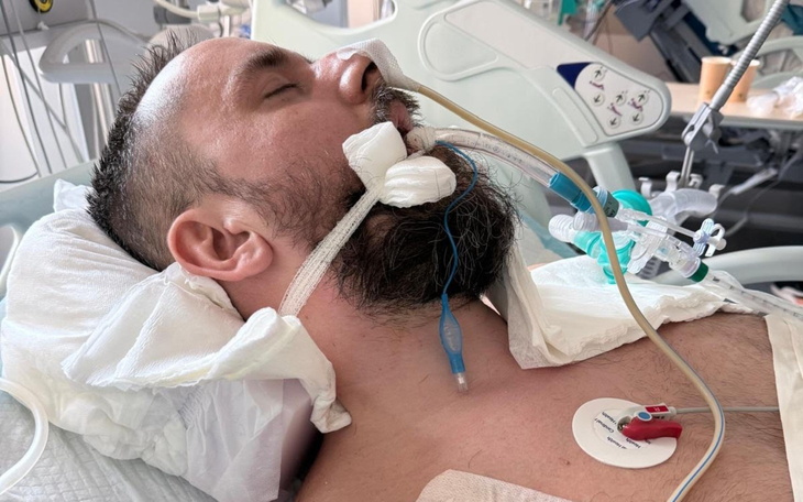 Mężczyzna w szpitalu z rurkami i aparaturą medyczną.