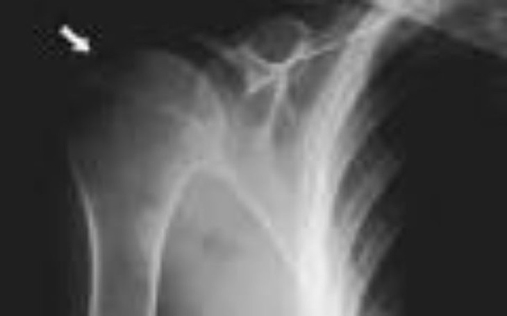 Zbiórka Leczenie rehabilitacja - zdjęcie główne