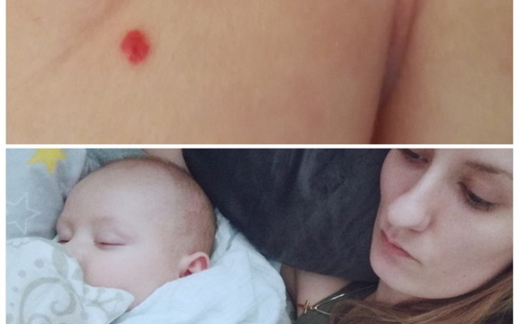 Zbiórka Pomoc dla Oskara i jego mamy - zdjęcie główne