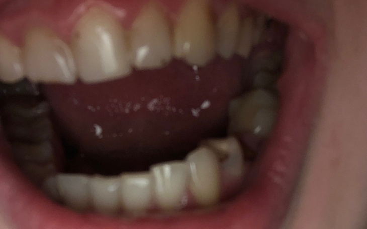 Zbiórka Potrzebuję pomocy dentystycznej - zdjęcie główne