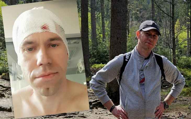 Mężczyzna z opatrunkiem na głowie stoi w lesie, wygląda na zamyślonego.