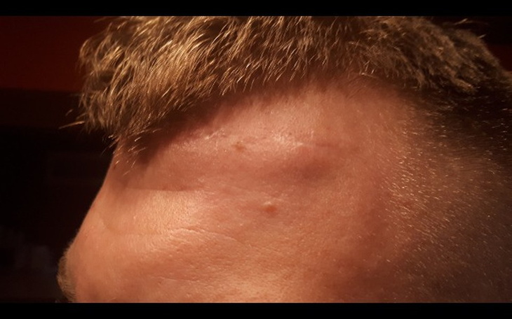 Zbiórka Rechabilitacja młodego ciała - zdjęcie główne