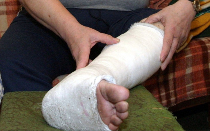 Zbiórka Rehabilitacja nogi po zlamaniu - zdjęcie główne