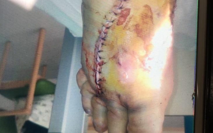 Zbiórka Pomoc dla Kuby na nogę - zdjęcie główne