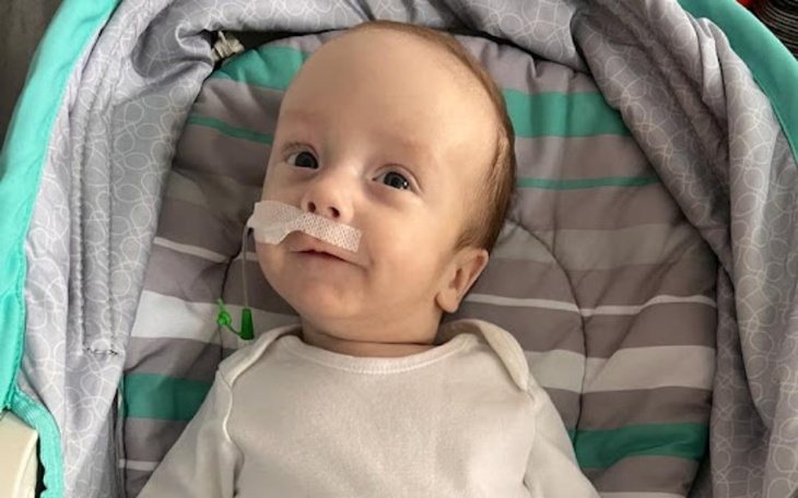 Małe dziecko leżące w wózku, z uśmiechem i opaską na nosie.