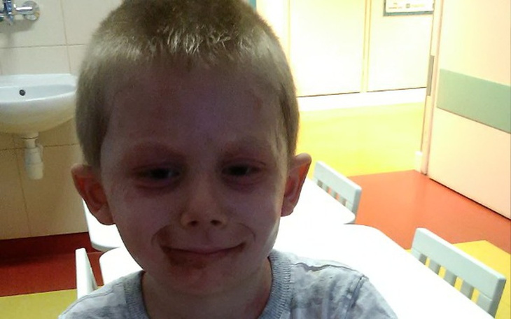 Zbiórka Leczenie kubulka - zdjęcie główne