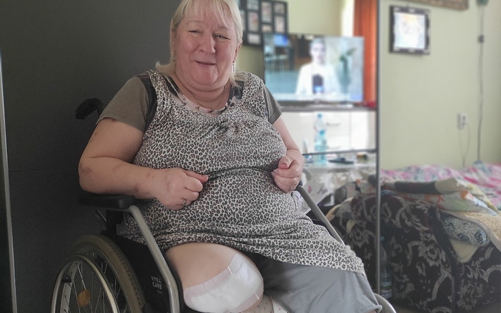 Zbiórka Proteza nogi Pani Ewy - zdjęcie główne