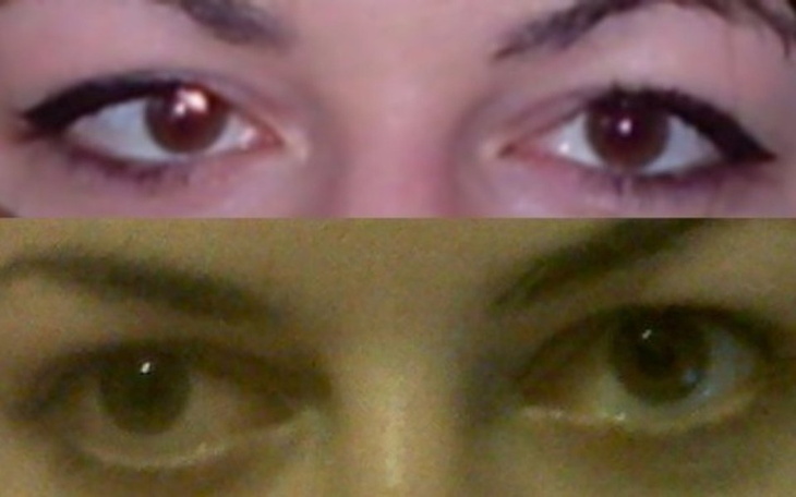 Zbiórka Naświetlanie oczu - zdjęcie główne