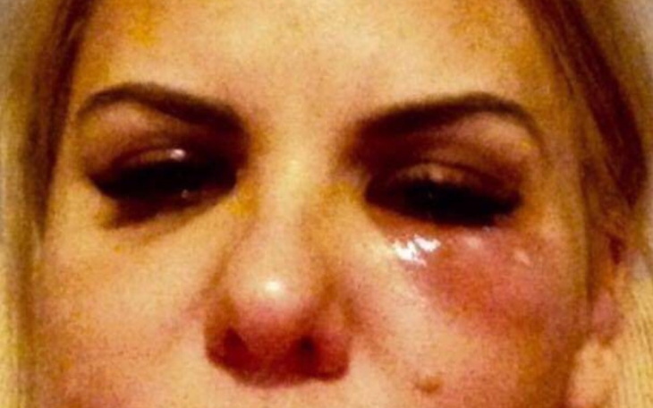 Zbiórka BezdoNosc - zdjęcie główne