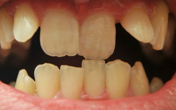 Zbiórka Zbieram na dentystę! - zdjęcie główne