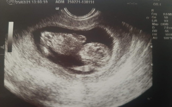 Zbiórka Na start dla noworodka - zdjęcie główne