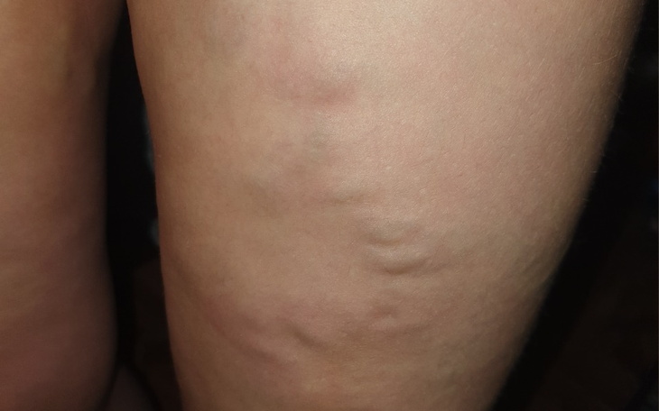 Zbiórka Na operacjie zylakow - zdjęcie główne