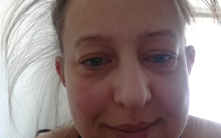 Zbiórka Guz w mózgu - zdjęcie główne