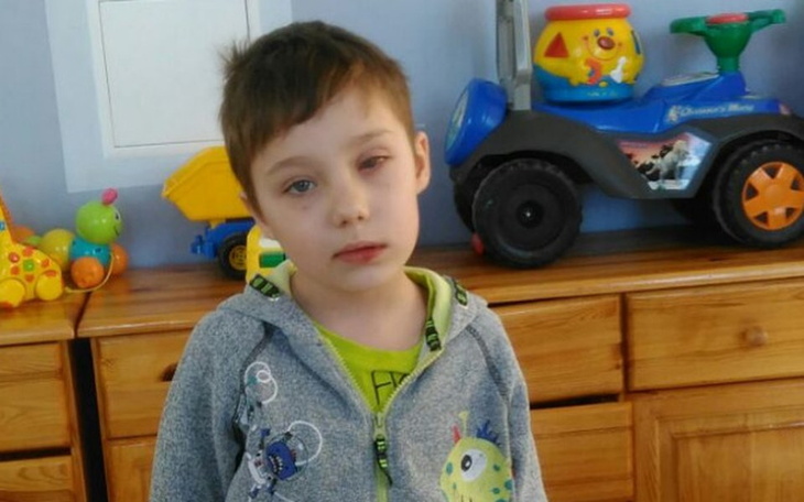 Zbiórka Pomóżmy Ksaweremu! - zdjęcie główne