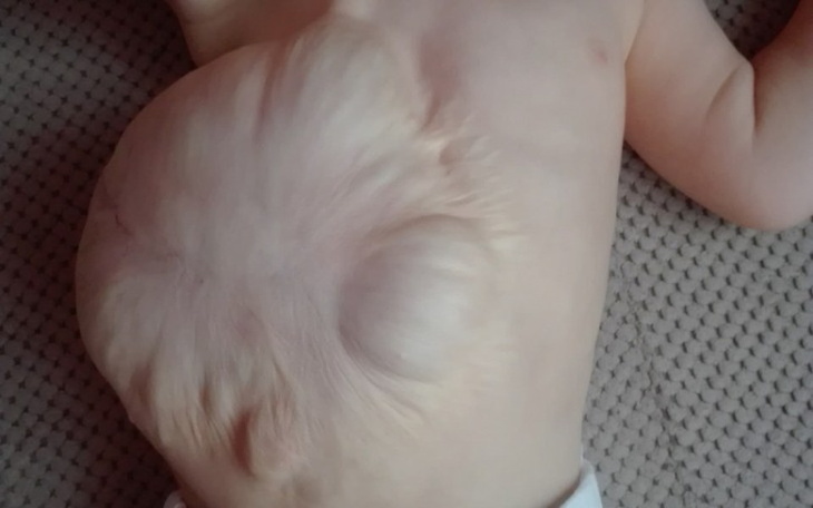 Zbiórka Pomóżmy Samirce - zdjęcie główne